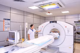 Chụp PET có phát hiện sớm ung thư?