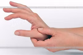 Phòng ngừa hội chứng ống cổ tay