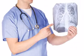 Thời tiết thất thường, cảnh giác với viêm phế quản cấp