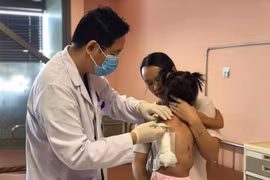 Cân não loại bỏ khối u mỡ khổng lồ cho bé gái 2 tuổi