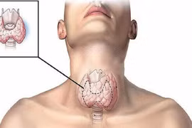 Sai lệch kết quả tuyến giáp vì sử dụng sản phẩm dưỡng da tóc
