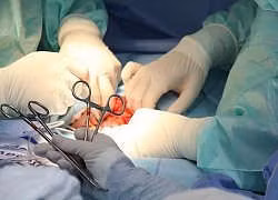 U sùi loét vì đắp thuốc