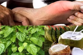 Uống nước dừa ngâm lá trầu không khỏi gút?