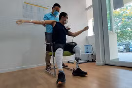 "Người đàn ông không thể ôm con" sau tai nạn phỏng điện đã được lắp hai tay giả! 