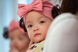 Hai bé Song Nhi xuất viện sau gần 3 tháng mổ tách dính thành công