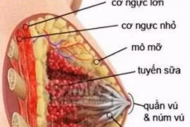 Rửa ống tuyến vú phát hiện sớm ung thư