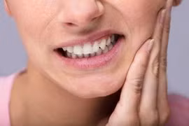 Bệnh viêm quanh răng và những điều bạn cần biết