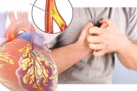 Trụy tim mạch vì sợ khám bệnh