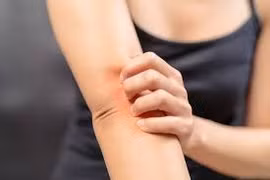 Nguyên nhân ngứa ngoài da
