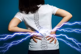  Đau lưng do thiếu vận động