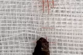 Dị vật văng vào tim