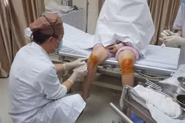 Liệu pháp tế bào gốc mô mỡ tự thân “Phân lập, lưu trữ, điều trị và ứng dụng thẩm mỹ”