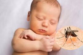 Lo lắng vì con hay bị muỗi đốt mùa sốt xuất huyết