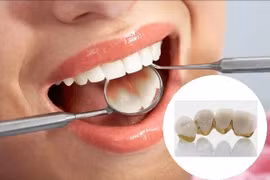 Suýt chết vì nhổ răng trong lúc có kinh
