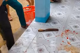 Cô giáo dùng dao tấn công đồng nghiệp