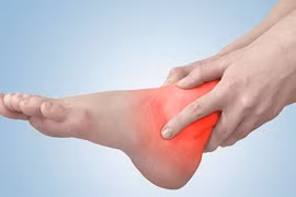 Thành tật vì bong gân xoa đắp thuốc nóng