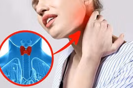 5 triệu chứng bệnh cường giáp bạn không thể bỏ qua