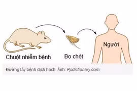 Bọ chét truyền bệnh dịch hạch