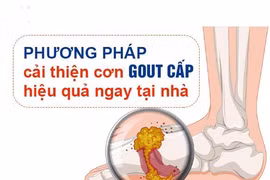 Ảnh minh họa.