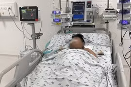 Sốt xuất huyết tăng nóng 