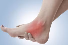Bong gân vì vội vượt rào