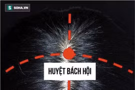 Day huyệt bách hội chữa huyết áp thấp, rối loạn tiền đình