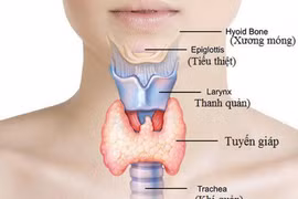 Khám, điều trị bệnh tuyến giáp thế nào?