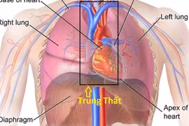  U trung thất ở nhiều vị trí khác nhau