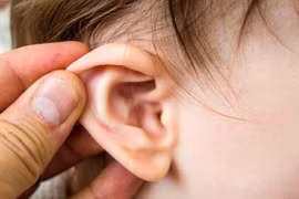 Viêm tai giữa lâu ngày nên tầm soát lao tai 