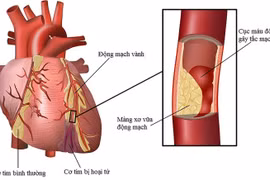 Thực phẩm giúp giảm lượng mỡ máu