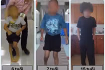 Kỹ thuật cắt rễ thần kinh chọn lọc giúp trẻ bại não cải thiện vận động