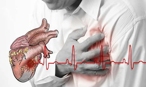 Tác dụng phụ đáng sợ của Aspirin đối với cơ thể