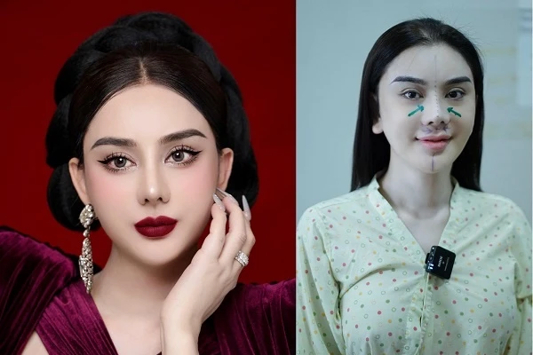 Lâm Khánh Chi khoe mũi mới chỉnh sửa