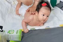 Khăn hăm Dr.Papie: Giải pháp 2 trong 1 hỗ trợ ngừa hăm vùng tã