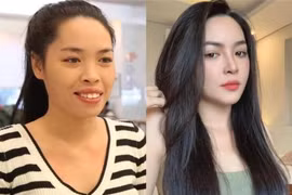 Nhan sắc hiện tại của hot girl từng 'lột xác' nhờ phẫu thuật thẩm mỹ