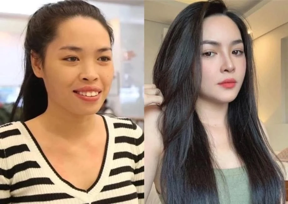 Nhan sắc hiện tại của hot girl từng 'lột xác' nhờ phẫu thuật thẩm mỹ