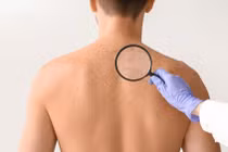 Thay đổi nhỏ trên da cảnh báo nguy cơ ung thư