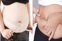 Mối hiểm họa từ mỡ nội tạng ở người trẻ