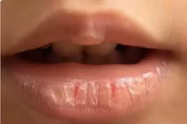 Vì sao dưỡng môi nhiều vẫn không hiệu quả?