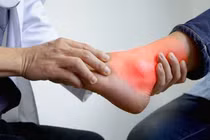 Lý do khiến người trẻ dễ mắc gút