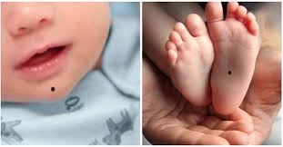 Trẻ có 1 trong 7 nốt ruồi này: Tương lai sáng chói, ắt làm quan