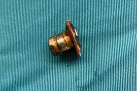 Bé 2 tuổi ở Phú Thọ thoát nguy kịch sau khi nuốt pin cúc áo