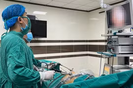 Tự ý dùng thuốc tại nhà, một người bị thủng ổ loét hành tá tràng