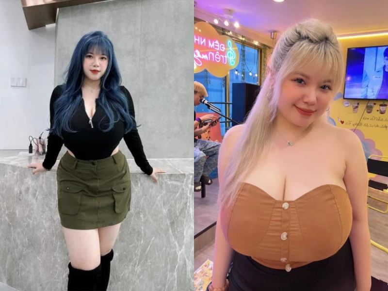 Nữ sinh Hải Dương từng phải phẫu thuật thu nhỏ vòng 1 giờ ra sao?