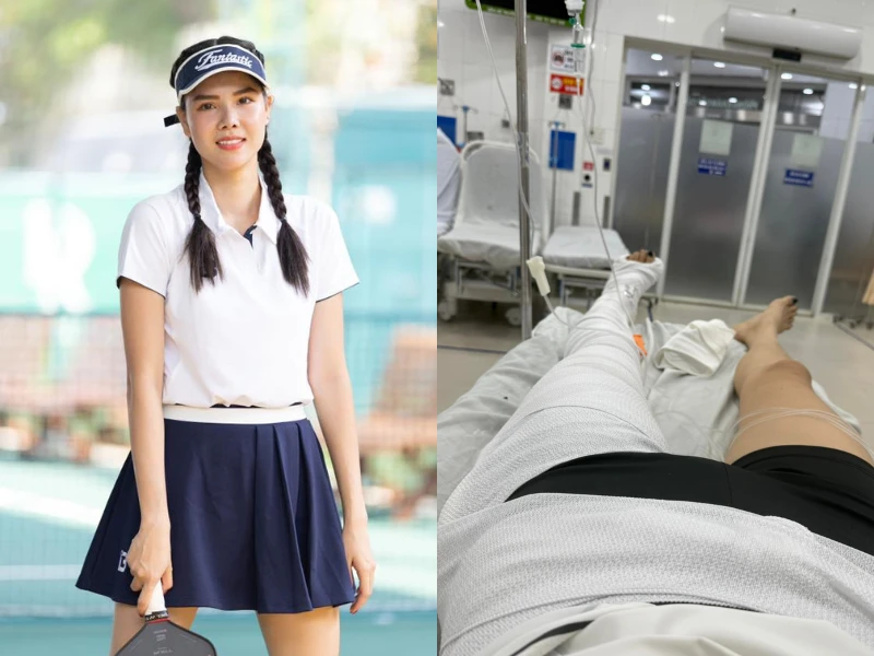 Siêu mẫu Kỳ Hân chấn thương với đôi chân “ngàn vàng” trên sân pickleball