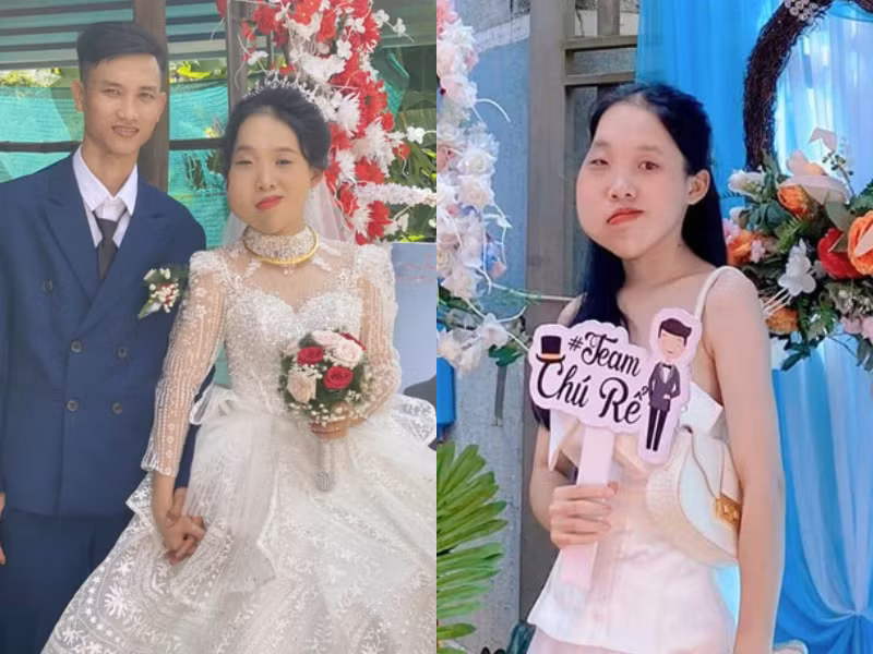 Cô gái mặt lệch từng bị chê ngoại hình, giờ chồng cưng hết mực