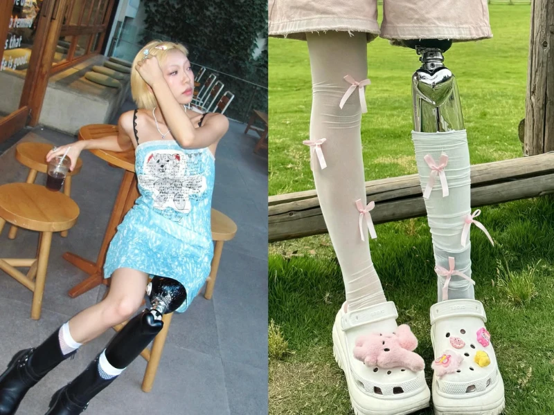 Nữ người mẫu mất một chân vẫn khiến fan mê đắm