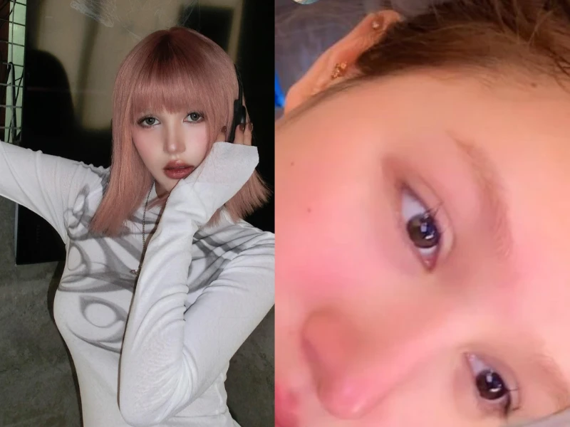 Xoài Non đăng ảnh khóc sưng mắt, lý do là gì?