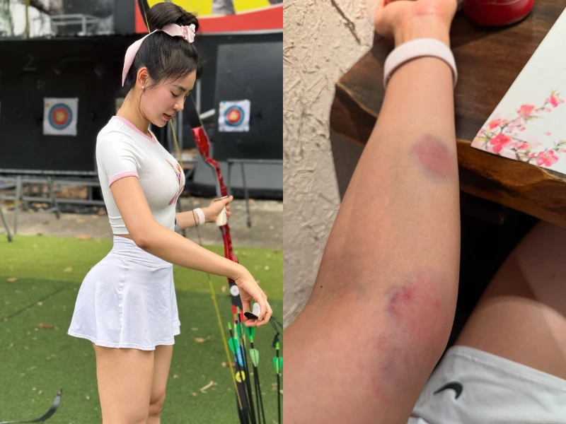 Thử sức với bắn cung, hot girl gym để lộ cánh tay bầm tím