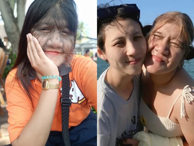 Diện mạo cô gái nhiều lông nhất thế giới khi cạo sạch lông mặt